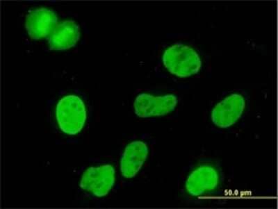 Immunocytochemistry/Immunofluorescence: MCM3 Antibody (3E1) [H00004172-M03] - Analysis of monoclonal antibody to MCM3 on HeLa cell. Antibody concentration 10 ug/ml