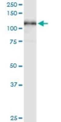 Western Blot: MCM3 Antibody (3E11) [H00004172-M06] - Analysis of MCM3 expression in human spleen.