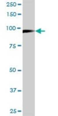 Western Blot: MCM3 Antibody (4F7) [H00004172-M01] - MCM3 monoclonal antibody (M01), clone 4F7. Analysis of MCM3 expression in Daoy.