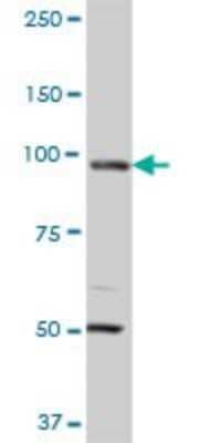 Western Blot: MCM3 Antibody (4F7) [H00004172-M01] - MCM3 monoclonal antibody (M01), clone 4F7. Analysis of MCM3 expression in human colon.