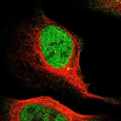 Immunocytochemistry/Immunofluorescence: MCM3 Antibody [NBP1-85796] - Immunofluorescent staining of human cell line U-2 OS shows localization to nucleoplasm & centrosome.