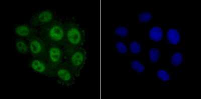 Immunocytochemistry/Immunofluorescence: MCM3 Antibody (JB99-35) [NBP2-75569] - Staining MCM3 in HepG2 cells (green). The nuclear counter stain is DAPI (blue). Cells were fixed in paraformaldehyde, permeabilised with 0.25% Triton X100/PBS.