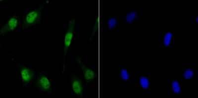 Immunocytochemistry/Immunofluorescence: MCM3 Antibody (JB99-35) [NBP2-75569] - Staining MCM3 in SH-SY-5Y cells (green). The nuclear counter stain is DAPI (blue). Cells were fixed in paraformaldehyde, permeabilised with 0.25% Triton X100/PBS.