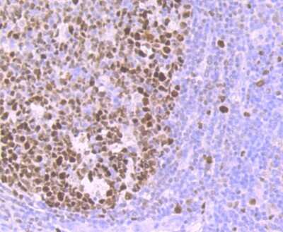 Immunohistochemistry-Paraffin: MCM3 Antibody (JB99-35) [NBP2-75569] - Analysis of paraffin-embedded human tonsil tissue using anti-MCM3 antibody. Counter stained with hematoxylin.