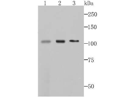 Western Blot: MCM3 Antibody (JB99-35) [NBP2-75569] - Analysis of MCM3 on mouse thymus tissue (1), NIH-3T3 cell (2) and Hela (3)cell lysates using anti-MCM3 antibody at 1/500 dilution.