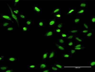 Immunocytochemistry/Immunofluorescence: MCM4 Antibody [H00004173-D01P] - Analysis of antibody to MCM4 on HeLa cell. Antibody concentration 20 ug/ml.