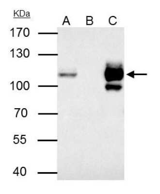 Immunoprecipitation: MCM4 Antibody [NBP1-33105] - MCM4 antibody immunoprecipitates MCM4 protein in IP experiments. IP samples: Jurkat whole cell extract. A. 40 ug Jurkat whole cell extract. B. Control with 4 ug of preimmune Rabbit IgG. C. Immunoprecipitation of MCM4 protein by 4 ug MCM4 antibody. 7.5 % SDS-PAGE. The immunoprecipitated MCM4 protein was detected by MCM4 antibody diluted at 1:500.