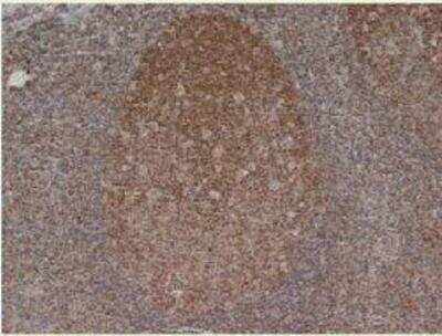 Immunohistochemistry-Paraffin: MCM5 Antibody (CRCT5.1) [NB100-65643] - Staining of formalin fixed, paraffin embedded human tonsil with Mouse anti Humann MCM5.