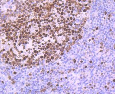 Immunohistochemistry-Paraffin: MCM5 Antibody (JB31-34) [NBP2-75570] - Analysis of paraffin-embedded human tonsil tissue using anti-MCM5 antibody. Counter stained with hematoxylin.