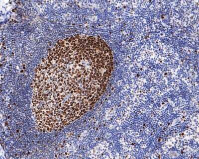 Immunohistochemistry-Paraffin: MCM5 Antibody (JB31-34) [NBP2-75570] - Analysis of paraffin-embedded human lymph nodes tissue with Rabbit anti-MCM5 antibody washed with ddH2O and PBS, and then probed with the primary antibody  at 1/400 dilution for 1 hour at room temperature. The detection was performed using an HRP conjugated compact polymer system. DAB was used as the chromogen. Tissues were counterstained with hematoxylin and mounted with DPX.