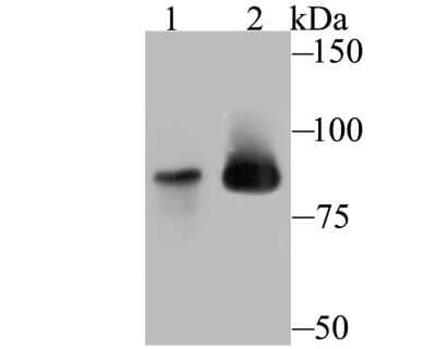 Western Blot: MCM5 Antibody (JB31-34) [NBP2-75570] - Analysis of MCM5 on different lysates using anti-MCM5 antibody at 1/500 dilution.Positive control:Lane 1: Mouse thymus tissue  Lane 2: SiHa
