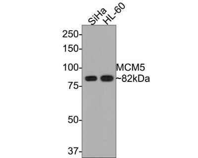 Western Blot: MCM5 Antibody (JB31-34) [NBP2-75570] - Analysis of MCM5 on different lysates with Rabbit anti-MCM5 antibody at 1/500 dilution. Lane 1: SiHa cell lysate Lane 2: HL-60 cell lysate Lysates/proteins at 10 ug/Lane. Predicted band size: 82 kDa Observed band size: 82 kDa Exposure time: 30 seconds; 8% SDS-PAGE gel. Proteins were transferred to a PVDF membrane and blocked with 5% NFDM/TBST for 1 hour at room temperature. The primary antibody at 1/500 dilution was used in 5% NFDM/TBST at room temperature for 2 hours. Goat Anti-Rabbit IgG - HRP Secondary Antibody at 1:300,000 dilution was used for 1 hour at room temperature.