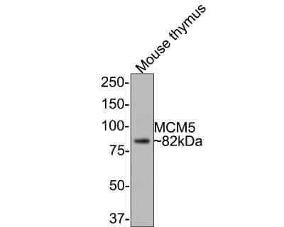 Western Blot: MCM5 Antibody (JB31-34) [NBP2-75570] - Analysis of MCM5 on mouse testis tissue lysates with Rabbit anti-MCM5 antibody at 1/500 dilution. Lysates/proteins at 20 ug/Lane. Predicted band size: 82 kDa Observed band size: 82 kDa Exposure time: 1 minute; 8% SDS-PAGE gel. Proteins were transferred to a PVDF membrane and blocked with 5% NFDM/TBST for 1 hour at room temperature. The primary antibody at 1/500 dilution was used in 5% NFDM/TBST at room temperature for 2 hours. Goat Anti-Rabbit IgG - HRP Secondary Antibody at 1:300,000 dilution was used for 1 hour at room temperature.