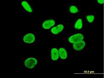 Immunocytochemistry/Immunofluorescence: MCM6 Antibody [H00004175-B01P] - Analysis of purified antibody to MCM6 on HeLa cell. (antibody concentration 10 ug/ml)