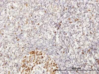 Immunohistochemistry-Paraffin: MCM6 Antibody [H00004175-B01P] - Analysis of purified antibody to MCM6 on formalin-fixed paraffin-embedded human lymph node. (antibody concentration 3 ug/ml)