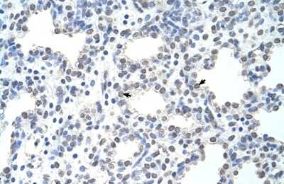 Immunohistochemistry-Paraffin: MCM6 Antibody [NBP1-58075] - Human Intestine Tissue, antibody concentration 4-8ug/ml. Cells with positive label: Epithelial cells of intestinal villus (indicated with arrows) 400X magnification.