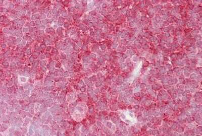 Immunohistochemistry-Paraffin: MCM6 Antibody [NBP1-58075] - Human thymus.