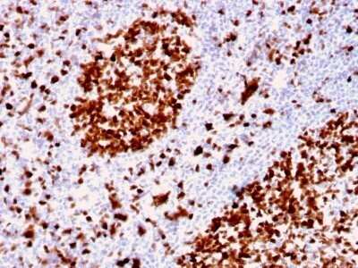 Immunohistochemistry-Paraffin: MCM6 Antibody (MCM6/2999) - Azide and BSA Free [NBP2-79862] - Formalin-fixed, paraffin-embedded human Tonsil stained with MCM6 Antibody (MCM6/2999).