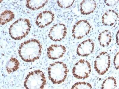 Immunohistochemistry-Paraffin: MCM6 Antibody (MCM6/2999) - Azide and BSA Free [NBP2-79862] - Formalin-fixed, paraffin-embedded human Colon stained with MCM6 Antibody (MCM6/2999).