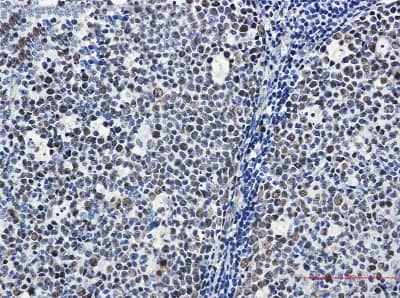 Immunohistochemistry-Paraffin: MCM6 Antibody (S02-2I2) [NBP3-19486] - Immunohistochemistry of MCM6 in paraffin-embedded Human tonsil using NBP3-19486 at dilution 1/50