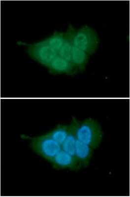 Immunocytochemistry/Immunofluorescence: MCM7 Antibody (118H7) [NBP2-60247] - Staining in MCF7 cells. The secondary antibody (green) was Alexa Fluor 488. DAPI was stained the cell nucleus (blue).