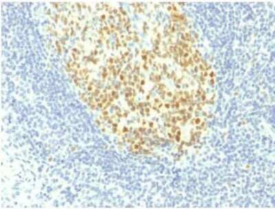 Immunohistochemistry-Paraffin: MCM7 Antibody (MCM7/1467) - Azide and BSA Free [NBP2-59609] - Formalin-fixed, paraffin-embedded human Tonsil stained withMCM7 Mouse Monoclonal Antibody (MCM7/1467).