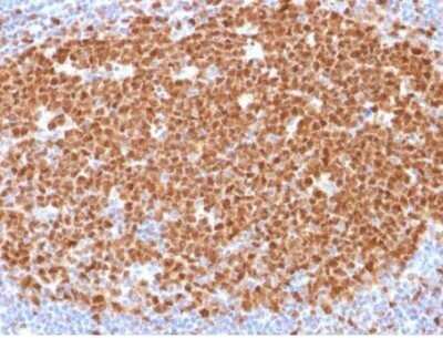 Immunohistochemistry-Paraffin: MCM7 Antibody (MCM7/1468) - Azide and BSA Free [NBP2-59611] - Formalin-fixed, paraffin-embedded human Tonsil stained withMCM7 Mouse Monoclonal Antibody (MCM7/1468).