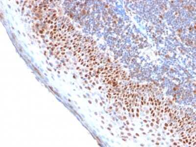 Immunohistochemistry-Paraffin: MCM7 Antibody (MCM7/2756R) - Azide and BSA Free [NBP3-08404] - Formalin-fixed, paraffin-embedded human Tonsil stained with MCM7 Recombinant Rabbit Monoclonal Antibody (MCM7/2756R).