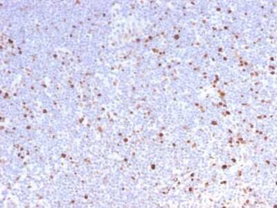 Immunohistochemistry-Paraffin: MCM7 Antibody (MCM7/2832R) - Azide and BSA Free [NBP3-08405] - Formalin-fixed, paraffin-embedded human Lymph Node stained with MCM7 Rabbit Recombinant Monoclonal Antibody (MCM7/2832R).
