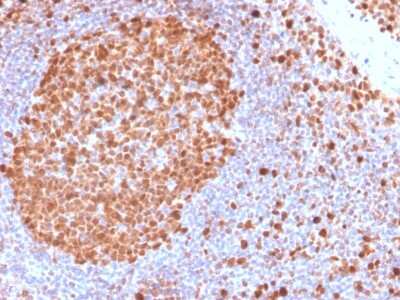 Immunohistochemistry-Paraffin: MCM7 Antibody (MCM7/2832R) - Azide and BSA Free [NBP3-08405] - Formalin-fixed, paraffin-embedded human Tonsil stained with MCM7 Rabbit Recombinant Monoclonal Antibody (MCM7/2832R).
