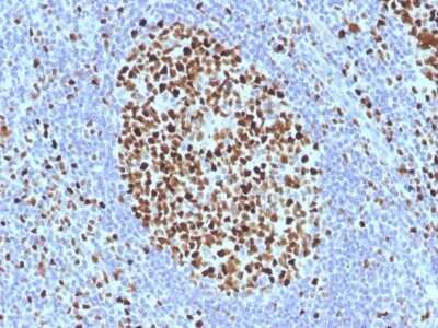 Immunohistochemistry-Paraffin: MCM7 Antibody (SPM379) - Azide and BSA Free [NBP2-54460] - Formalin-fixed, paraffin-embedded human Tonsil stained with MCM7 Monoclonal Antibody (SPM379).
