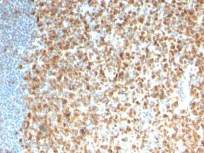 Immunohistochemistry-Paraffin: MCM7 Antibody (rMCM7/1468) [NBP3-08389] - Formalin-fixed, paraffin-embedded human Tonsil stained with MCM7 Recombinant Mouse Monoclonal Antibody (rMCM7/1468).