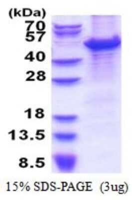 SDS-Page: MCM7 Recombinant Protein [NBP2-51540] - 15% SDS Page (3 ug)