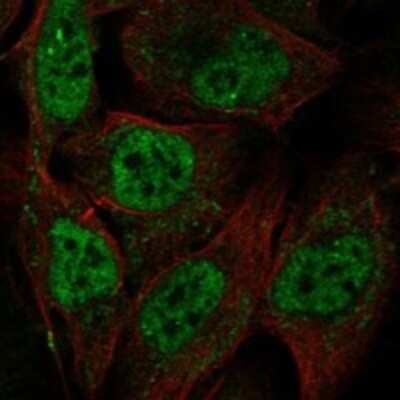 Immunocytochemistry/Immunofluorescence: MCM8 Antibody [NBP3-17736] - Staining of human cell line U-2 OS shows localization to nucleoplasm.