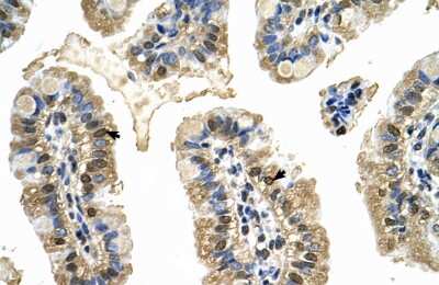 Immunohistochemistry-Paraffin: MCM8 Antibody [NBP1-58129] - Human Intestine Tissue, antibody concentration 4-8ug/ml. Cells with positive label: Epithelial cells of intestinal villus (indicated with arrows) 400X magnification.