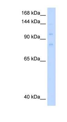 Western Blot: MCM8 Antibody [NBP1-58129] - 721_B cell lysate, Antibody Titration: 0.2-1 ug/ml