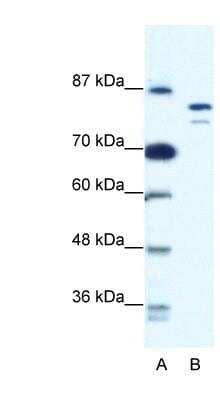 Western Blot: MCM8 Antibody [NBP1-58130] - Jurkat cell lysate, concentration 0.125ug/ml.