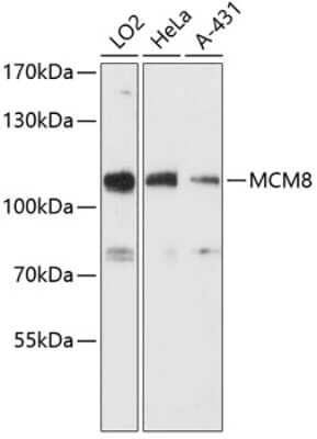 Western Blot: MCM8 Antibody [NBP3-05116] - Analysis of extracts of various cell lines, using MCM8 antibody at 1:3000 dilution. Secondary antibody: HRP Goat Anti-Rabbit IgG (H+L) at 1:10000 dilution. Lysates/proteins: 25ug per lane. Blocking buffer: 3% nonfat dry milk in TBST. Detection: ECL Basic