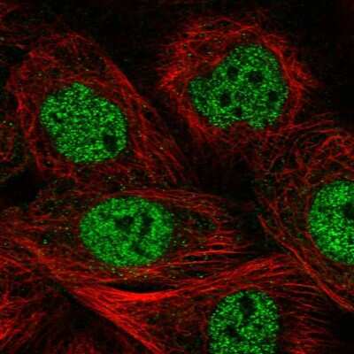 Immunocytochemistry/Immunofluorescence: MCM9 Antibody [NBP1-86740] - Immunofluorescent staining of human cell line A-431 shows localization to nucleoplasm.