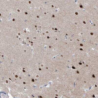 Immunohistochemistry-Paraffin: MCM9 Antibody [NBP1-86740] - Staining of human cerebral cortex shows strong nuclear positivity in neuronal cells.