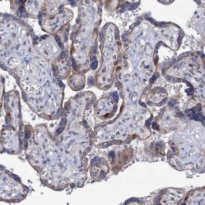 Immunohistochemistry-Paraffin: MCMBP Antibody [NBP1-90746] - Staining of human placenta shows moderate nuclear positivity in trophoblastic cells.