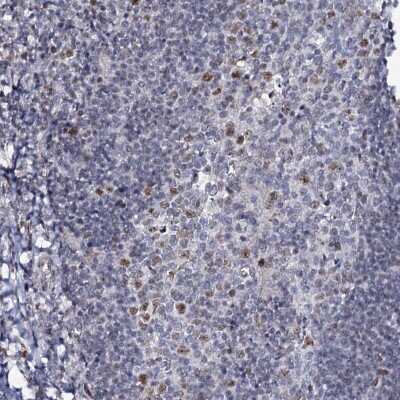 Immunohistochemistry-Paraffin: MCMBP Antibody [NBP1-90746] - Staining of human tonsil shows moderate nuclear positivity in germinal center cells.