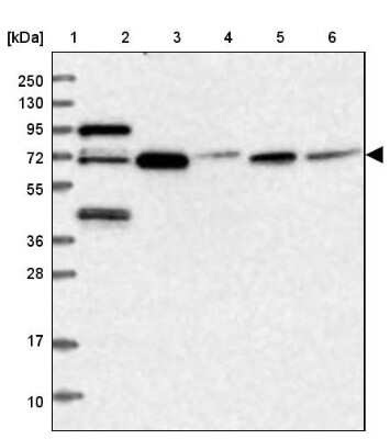 Western Blot: MCMBP Antibody [NBP1-90746] - Lane 1: Marker  [kDa] 250, 130, 95, 72, 55, 36, 28, 17, 10.  Lane 2: Human cell line RT-4.  Lane 3: Human cell line U-251MG sp.  Lane 4: Human plasma (IgG/HSA depleted).  Lane 5: Human liver tissue.  Lane 6: Human tonsil tissue
