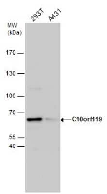 Western Blot: MCMBP Antibody [NBP2-43603] - Analysis of various whole cell extracts (30 ug) were separated by 7.5% SDS-PAGE, and the membrane was blotted with C10orf119 antibody diluted by 1:1000.