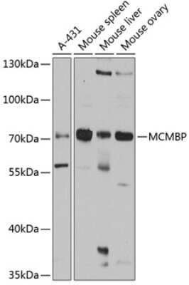 Western Blot: MCMBP Antibody [NBP3-04571] - Analysis of extracts of various cell lines, using MCMBP antibody at 1:1000 dilution. Secondary antibody: HRP Goat Anti-Rabbit IgG (H+L) at 1:10000 dilution. Lysates/proteins: 25ug per lane. Blocking buffer: 3% nonfat dry milk in TBST. Detection: ECL Basic Kit