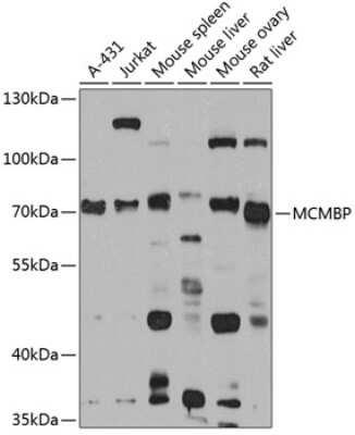 Western Blot: MCMBP Antibody [NBP3-04572] - Analysis of extracts of various cell lines, using MCMBP antibody at 1:1000 dilution. Secondary antibody: HRP Goat Anti-Rabbit IgG (H+L) at 1:10000 dilution. Lysates/proteins: 25ug per lane. Blocking buffer: 3% nonfat dry milk in TBST. Detection: ECL Basic Kit
