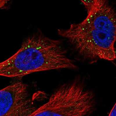 Immunocytochemistry/Immunofluorescence: MCPIP1/ZC3H12A Antibody [NBP2-37871] - Staining of human cell line U-251 MG shows localization to cytoplasmic bodies. Antibody staining is shown in green.