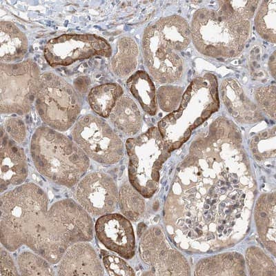 Immunohistochemistry-Paraffin: MCPIP1/ZC3H12A Antibody [NBP1-83587] - Staining of human kidney shows strong cytoplasmic positivity in cells in tubules.