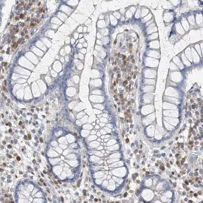 Immunohistochemistry-Paraffin: MCPIP1/ZC3H12A Antibody [NBP2-37871] - Staining of human colon shows moderate cytoplasmic positivity in lymphoid cells.