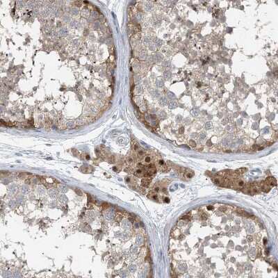 Immunohistochemistry-Paraffin: MCPIP1/ZC3H12A Antibody [NBP2-37871] - Staining of human testis shows moderate cytoplasmic and nuclear positivity in Leydig cells.